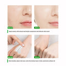 Retinol Whitening Cream for Private